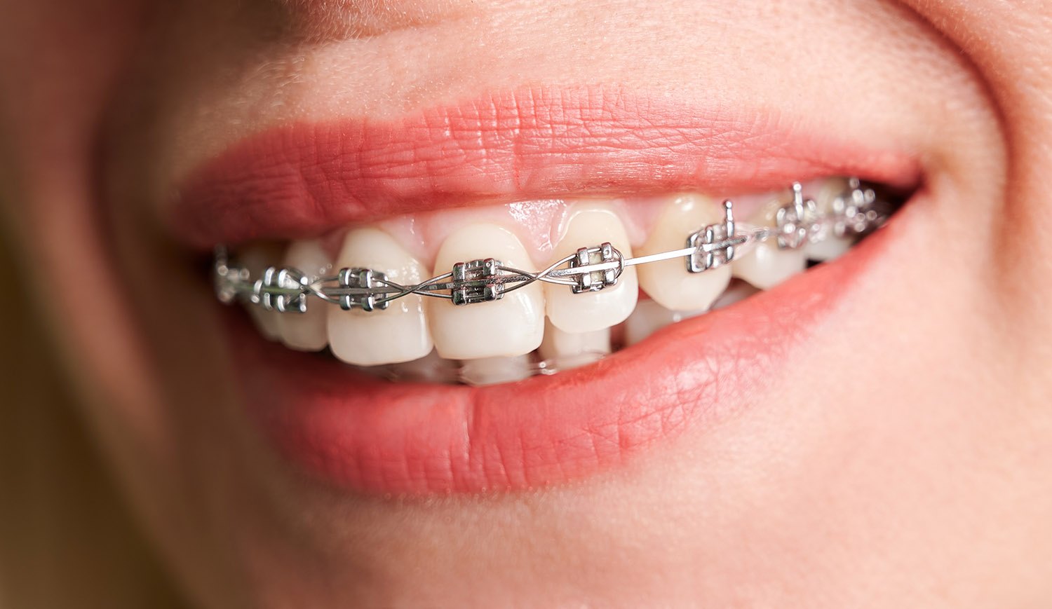 Traditional Brances Mouth Closeup